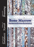 Bone Marrow Immunohistochemistry артикул 3648e.